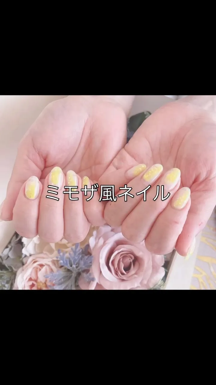 ミモザ風ネイル♡